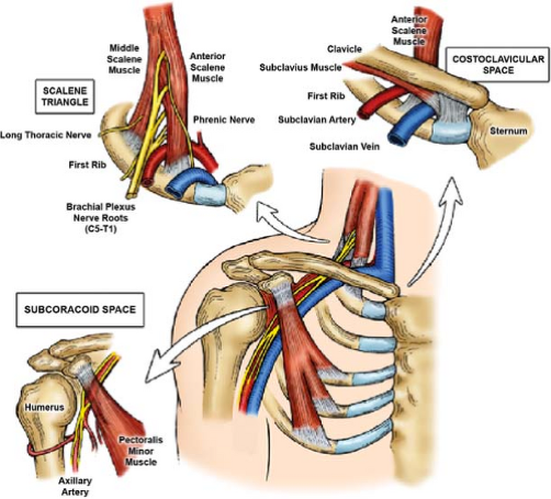 https://rydenaturalhealthclinic.com.au/wp-content/uploads/Diagram-of-where-the-Thoracic-Outlet-is-Located.png