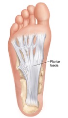 • The plantar fascia is a thick ligament that stretches from the base of your heel to the base of each of your toes.